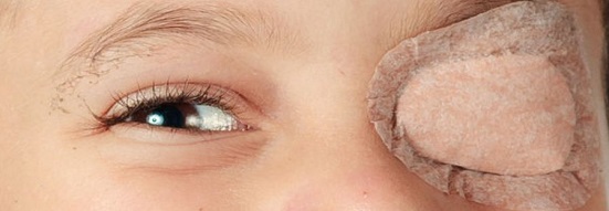 La Parábola del Joven Tuerto: Discriminación y conformismo